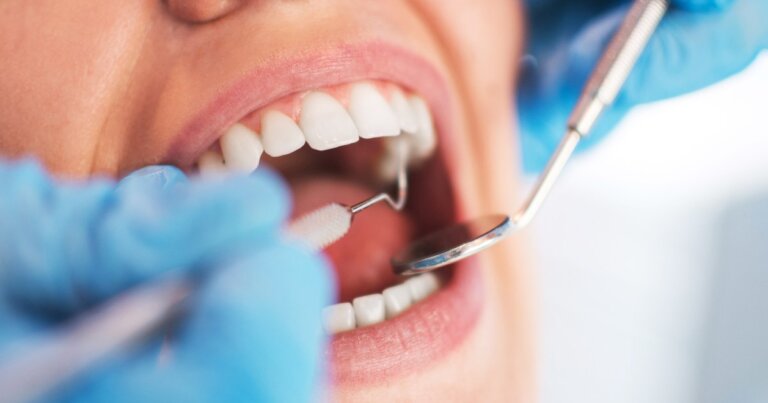 teeth cleaning toronto dentist