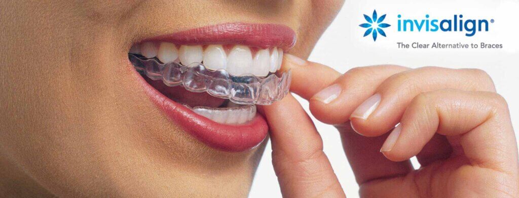 visit learn.invisalign.com