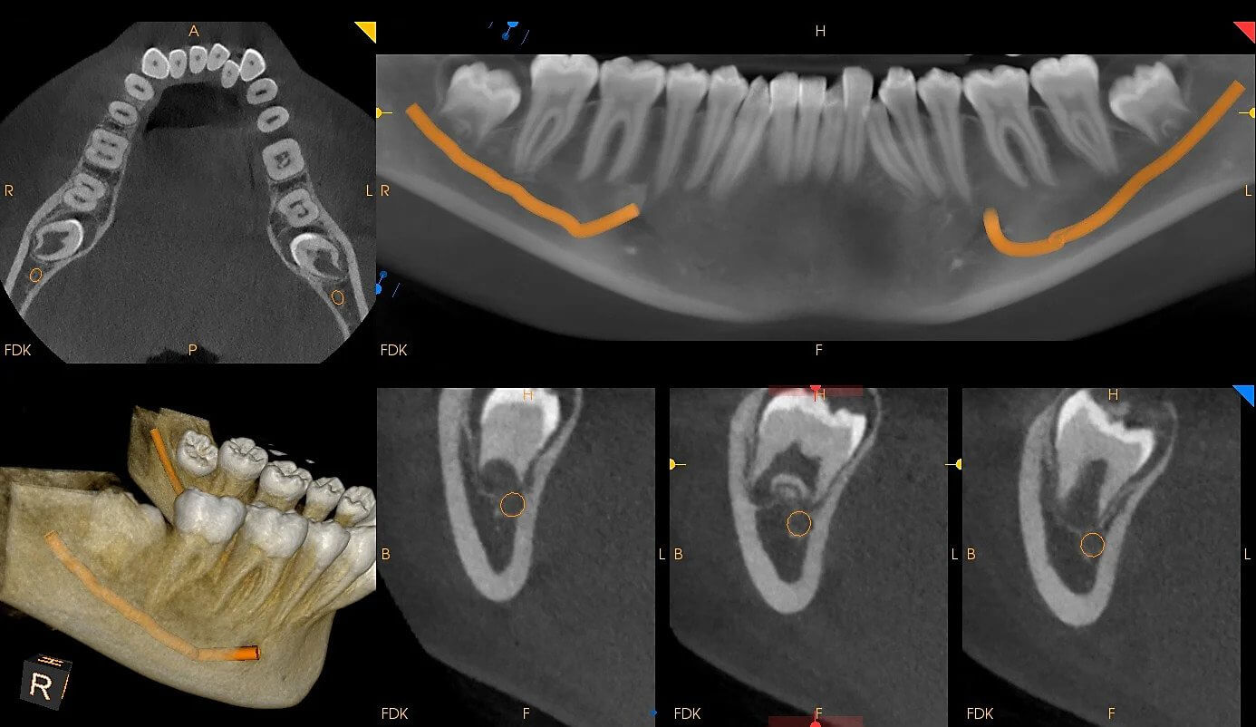 how-much-does-a-cbct-scan-cost-atlas-dental-toronto