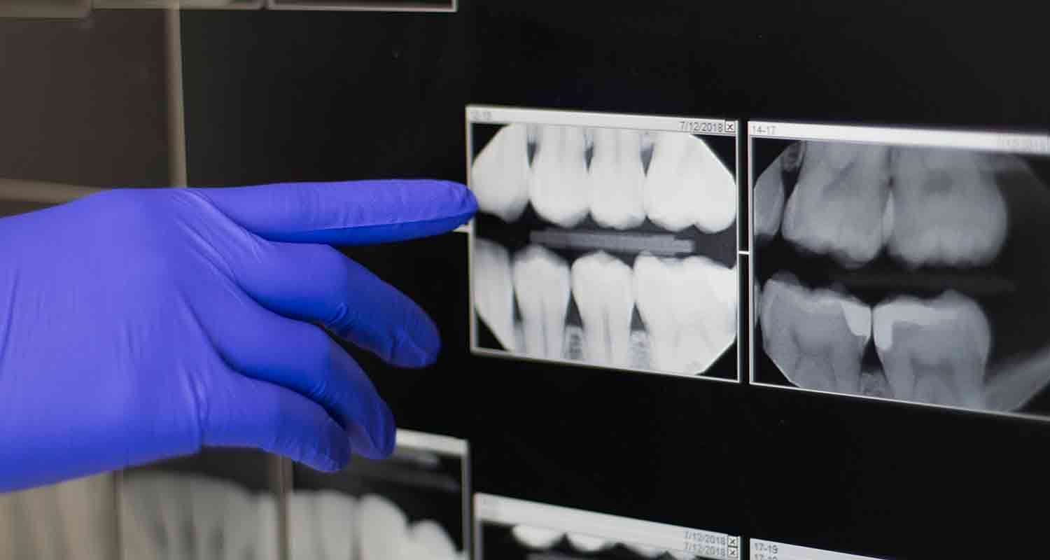 Dental X-rays and diagnostic imaging
