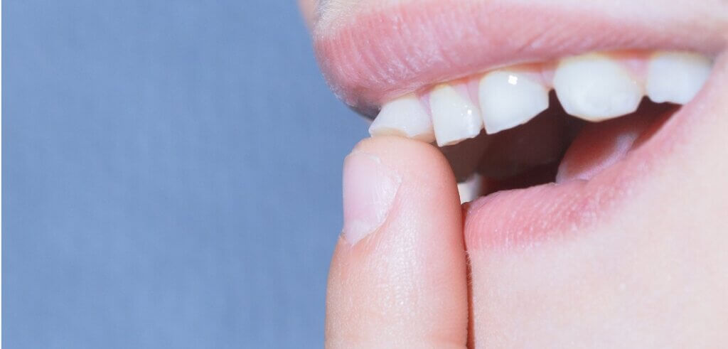 Tooth Trauma | Atlas Dental, Toronto Dentist