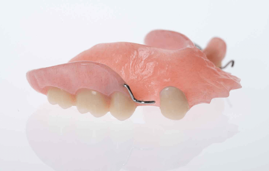 Acrylic Partial Denture Atlas Dental Toronto