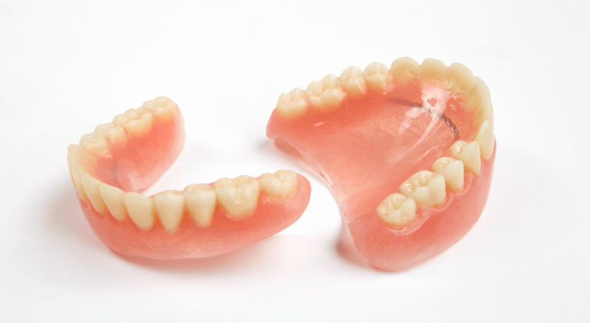 Tooth Supported Overdenture Atlas Dental Toronto