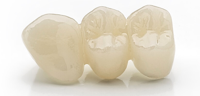 zirconia dental bridge