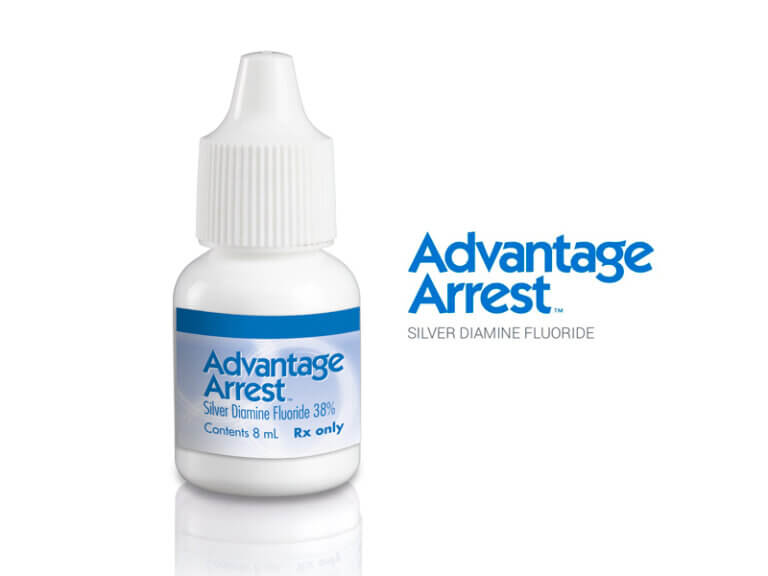 silver diamine fluoride advantage arrest